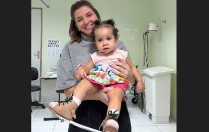 Santa Casa de Araçatuba recebe 40 órteses ortopédicas para crianças