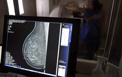 Saiba como solicitar mamografia digital sem erro