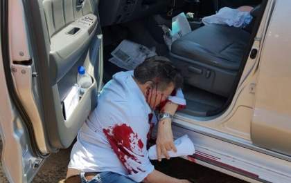 Ex-deputado federal Oscar Goldoni é assassinado em Ponta Porã