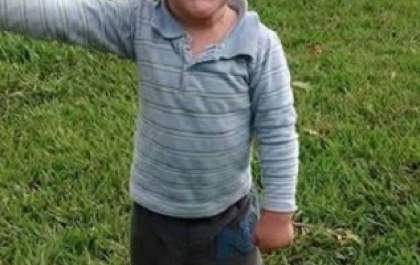 Criança de 2 anos morre com suspeita de picada de escorpião em sítio