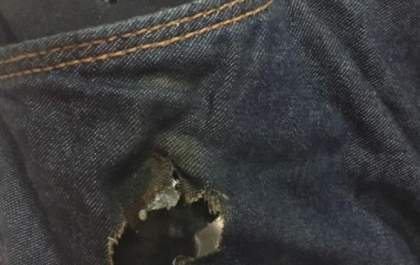 Celular explode dentro do bolso e rapaz fica ferido