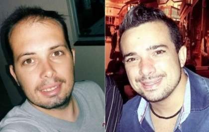 Acidente na madrugada de sábado mata dois homens de 28 anos na SP-294
