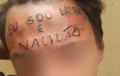 'Vaquinha' arrecada dinheiro para remover tatuagem de testa de adolescente do ABC