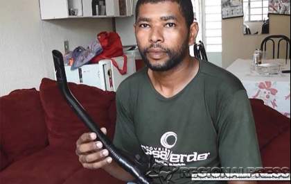 Homem leva picada de escorpião na língua, em Araçatuba