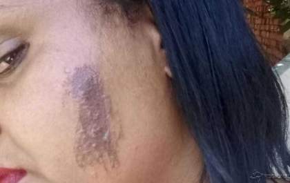 Cuidadora de idosos é torturada durante assalto e tem seio cortado
