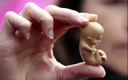 Sem dinheiro e condições emocionais, grávida pede ao STF para abortar