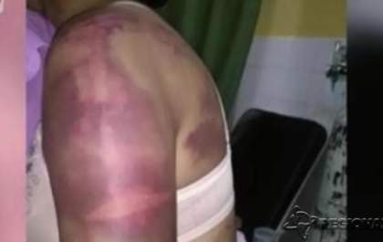 Marido bate em mulher por cada “like” que ela recebeu no Facebook