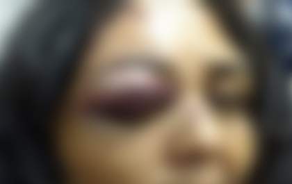 Mulher é esganada e tem celular destruído após negar sexo ao marido