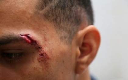 Homem ‘toca terror’, atira em jovens, tenta fugir da polícia, mas vai preso