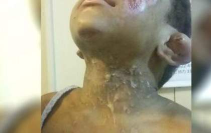 Avó que participou da tortura de neto é condenada a 16 anos de prisão