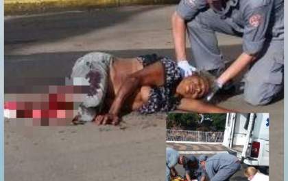 Mulher de 56 anos fica em estado grave após ser atropelada em Andradina