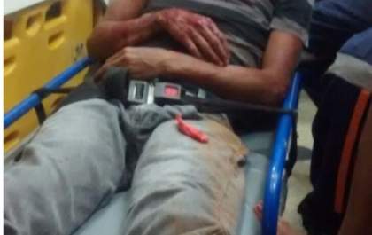 Rapaz agride com socos e chutes na cabeça irmão que dormia o sofá