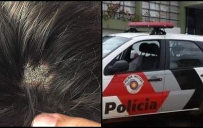 Estudante é ferido com soda cáustica em escola: Polícia investiga caso
