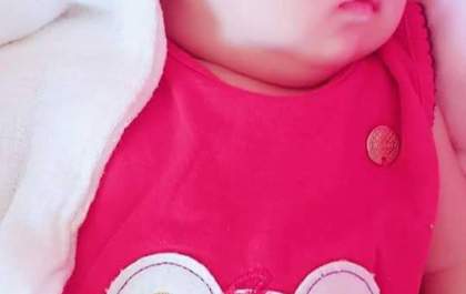 Pétra de quatro meses trava batalha contra tumor na cabeça e mãe pede ajuda