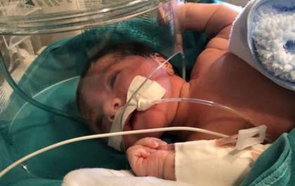 Bebê enterrada viva pela avó está na UTI em estado grave