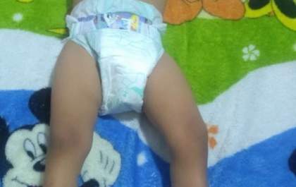 Mãe pede ajuda para filho que sofre com má formação nos pés