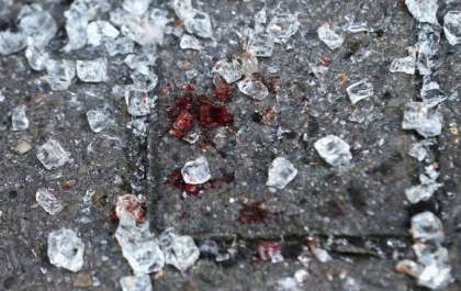 Após agredir a mulher com socos, marido risca corpo de vítima com caco de vidro