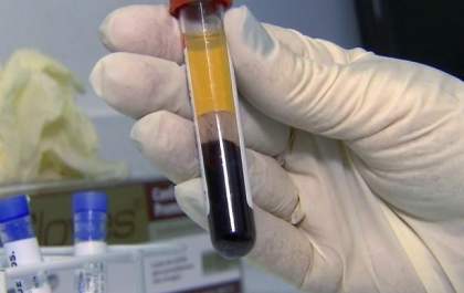 Saúde de Três Lagoas desde abril possui testes rápidos de diagnóstico da dengue
