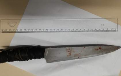 Mulher é esfaqueada no pescoço pelo marido após discussão