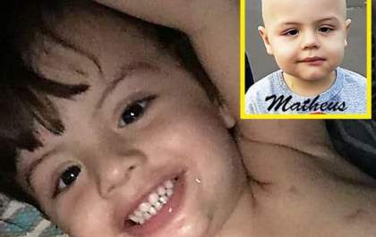 Criança tem leucemia confirmada 3 meses após morte do irmão