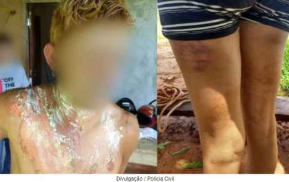 Mulher sequestrada e estuprada pelo ex queima homem para se livrar de torturas